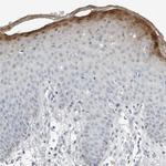 SERPINB7 Polyclonal Antibody