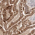 TRIM41 Antibody in Immunohistochemistry (Paraffin) (IHC (P))