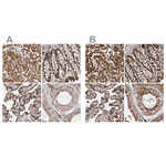 IARS2 Polyclonal Antibody
