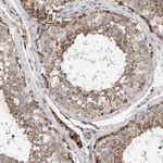 IARS2 Antibody in Immunohistochemistry (Paraffin) (IHC (P))