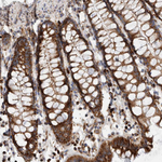 IARS2 Antibody in Immunohistochemistry (Paraffin) (IHC (P))