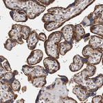 IARS2 Antibody in Immunohistochemistry (Paraffin) (IHC (P))