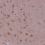 KIAA1107 Antibody in Immunohistochemistry (Paraffin) (IHC (P))