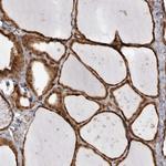 C1orf144 Antibody in Immunohistochemistry (Paraffin) (IHC (P))