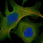 MYO10 Polyclonal Antibody