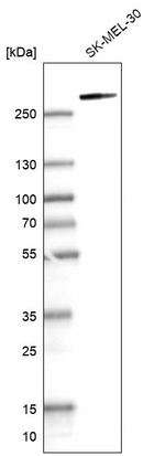 MYO10 Antibody in Western Blot (WB)