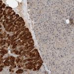ARMC7 Antibody in Immunohistochemistry (Paraffin) (IHC (P))
