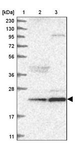 ARMC7 Antibody in Western Blot (WB)