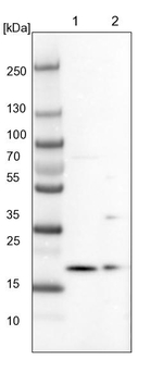 ARMC7 Antibody in Western Blot (WB)