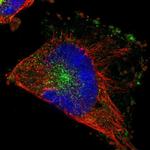 RABEP1 Polyclonal Antibody