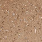RABEP1 Antibody in Immunohistochemistry (Paraffin) (IHC (P))