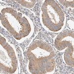 RABEP1 Antibody in Immunohistochemistry (Paraffin) (IHC (P))
