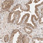 RABEP1 Antibody in Immunohistochemistry (Paraffin) (IHC (P))