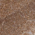 RABEP1 Antibody in Immunohistochemistry (Paraffin) (IHC (P))