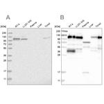 RABEP1 Antibody in Western Blot (WB)