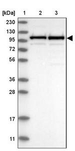 CPSF2 Antibody in Western Blot (WB)