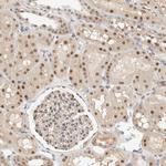 TSTD2 Polyclonal Antibody