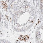 FAM71F2 Antibody in Immunohistochemistry (IHC)