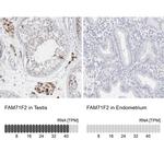 FAM71F2 Antibody