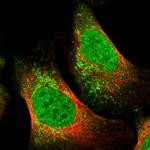 TNRC18 Polyclonal Antibody