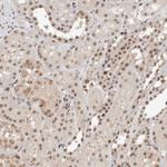 TNRC18 Antibody in Immunohistochemistry (Paraffin) (IHC (P))