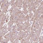 POPDC2 Antibody in Immunohistochemistry (IHC)