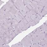 POPDC2 Antibody in Immunohistochemistry (IHC)