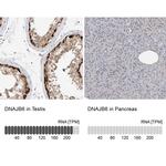 DNAJB6 Polyclonal Antibody