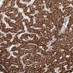 WDR91 Polyclonal Antibody