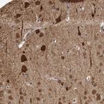 OR2K2 Polyclonal Antibody