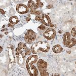 SCIN Polyclonal Antibody