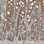 SEL1L Antibody in Immunohistochemistry (Paraffin) (IHC (P))
