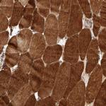PRDM15 Antibody in Immunohistochemistry (Paraffin) (IHC (P))