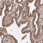 SNX31 Antibody in Immunohistochemistry (Paraffin) (IHC (P))