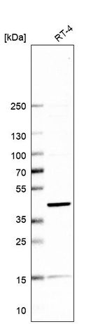 SNX31 Antibody in Western Blot (WB)
