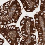 RHPN1 Antibody in Immunohistochemistry (Paraffin) (IHC (P))