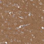Dematin Polyclonal Antibody