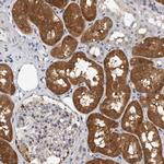 FBXO43 Polyclonal Antibody