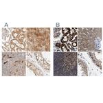 CCDC44 Polyclonal Antibody