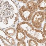 CCDC44 Antibody in Immunohistochemistry (IHC)