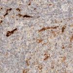 CCDC44 Antibody in Immunohistochemistry (IHC)