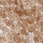 CCDC44 Antibody in Immunohistochemistry (IHC)