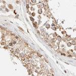 CCDC44 Antibody in Immunohistochemistry (IHC)
