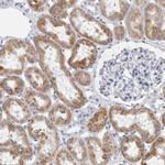 B3GNT3 Antibody in Immunohistochemistry (Paraffin) (IHC (P))