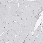 B3GNT3 Antibody in Immunohistochemistry (Paraffin) (IHC (P))