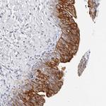 RPH3AL Polyclonal Antibody