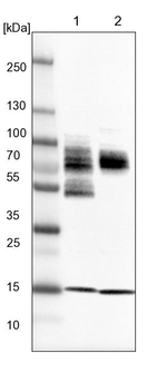 ZSCAN2 Antibody in Western Blot (WB)