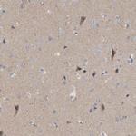 GDAP1 Antibody in Immunohistochemistry (IHC)