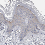 OTOR Antibody in Immunohistochemistry (Paraffin) (IHC (P))