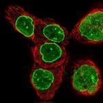 TPR Polyclonal Antibody